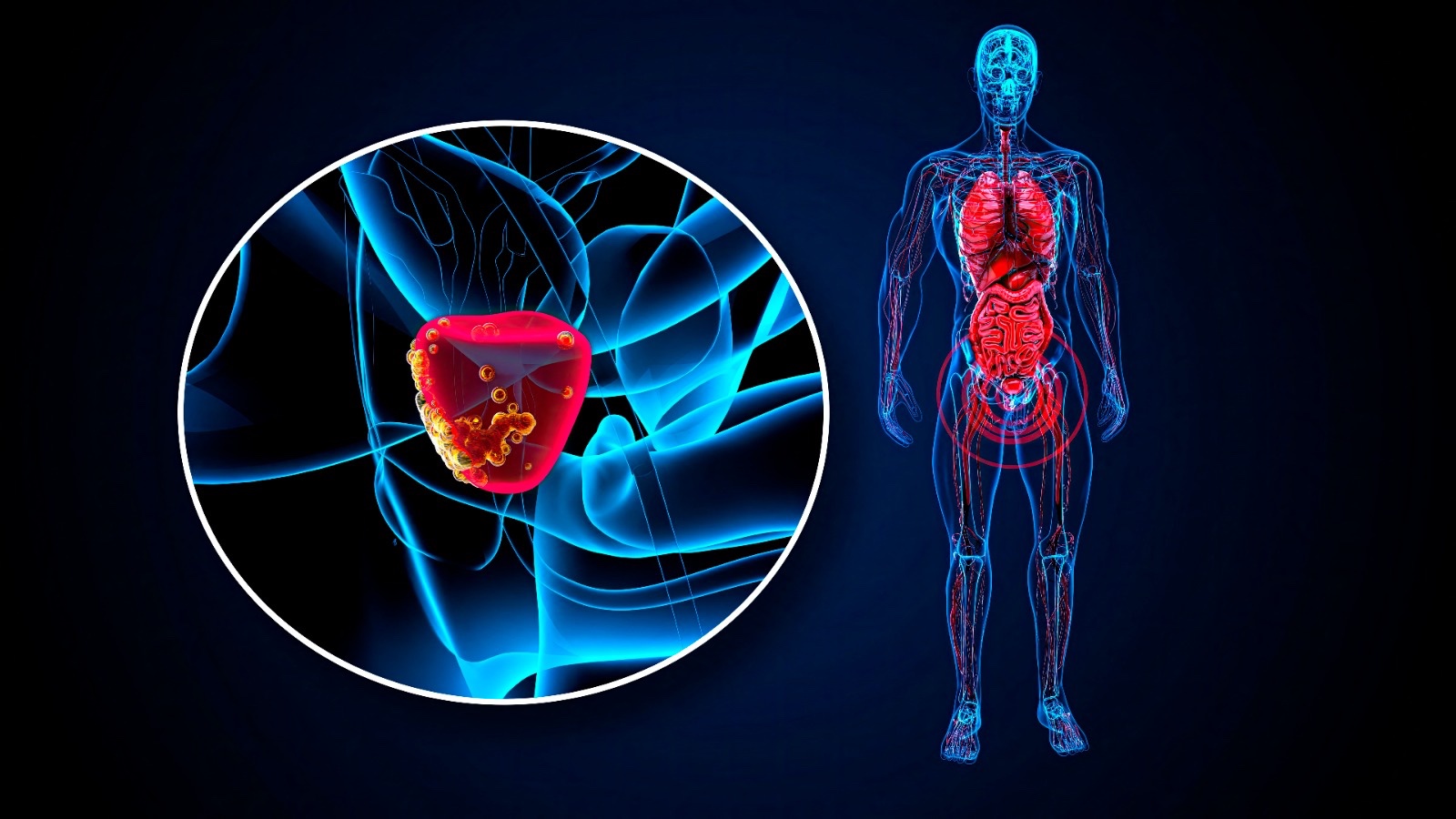 علاج يخفف الهبات الساخنة لدى مرضى “سرطان البروستاتا علاج يخفف الهبات الساخنة لدى مرضى “سرطان البروستاتا