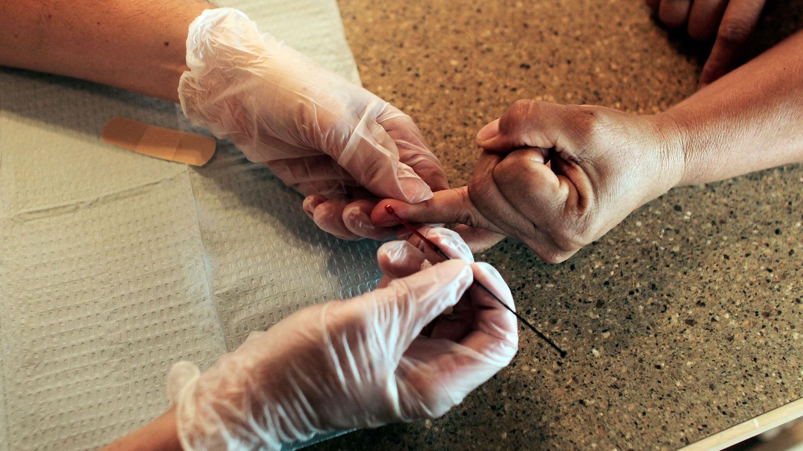 علاج للكوليسترول يقلل خطر أمراض القلب والأوعية 25% علاج للكوليسترول يقلل خطر أمراض القلب والأوعية 25%