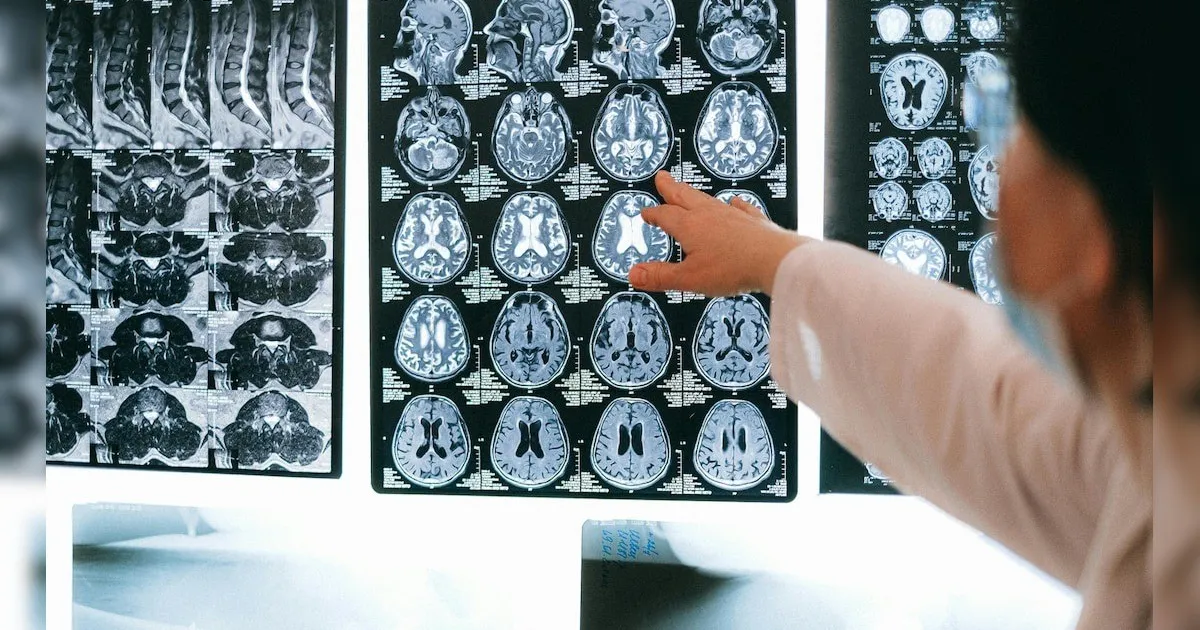 الهند.. 19 حالة وفاة بسبب "الأميبا آكلة الدماغ" والسلطات تعلن التأهب