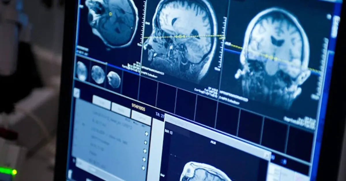 ماذا يحمي الدماغ من التدهور المعرفي؟