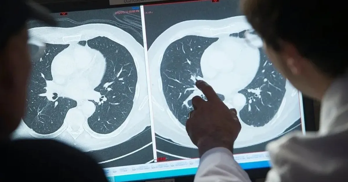 التدخين والسمنة في صدارة أسباب السرطان وفق دراسة دولية