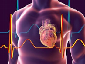 النوبة القلبية.. الأعراض وعوامل الخطر