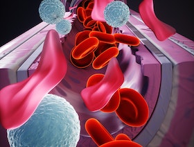 فقر الدم اللاتنسجي.. الأعراض والأسباب والوقاية