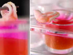 تقنية جديدة تسمح بطباعة ثلاثية الأبعاد للعظام داخل جسم الإنسان