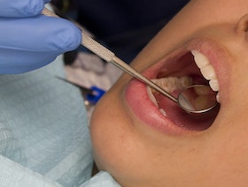 دراسة: سوء حالة الأسنان تؤثر على صحة الدماغ