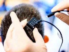 باحثون يطورون شريحة دماغية تترجم الأفكار إلى كلام منطوق