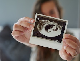 دراسة: كورونا لا يقتل الأجنة لكنه قد يؤدي للولادة المبكرة