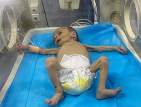 رئيس بعثة المجلس الدولي لحقوق الإنسان: بنود التصنيف العالمي للمجاعة "مثبتة" في غزة