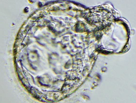 دراسة: الجنين "يعتني بنفسه" في بداية الحمل