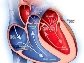 فتح الشرايين المسدودة يقلل من خطر الوفاة بسبب أمراض القلب