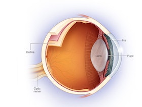 التهاب العصب البصري.. هل يُسبب فقدان البصر؟
