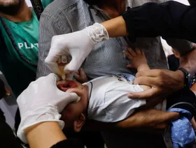 الحرب والمجاعة تزيدان التشوهات الخلقية والولادات المبكرة في غزة