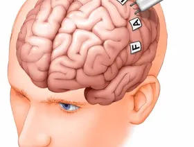 علماء كنديون يتوصلون إلى آلية لإبطاء نمو سرطان الدماغ.. وعقار قد يوقفها