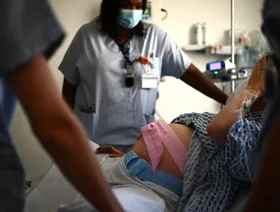 تحذيرات طبية من التوسع غير المبرر في الولادة القيصرية.. لماذا؟