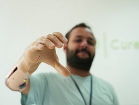 شركة ناشئة تونسية تصنع أطرافاً اصطناعية تعمل بالـذكاء الاصطناعي
