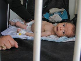على شفا المجاعة.. ماذا يفعل الجوع بأطفال غزة؟