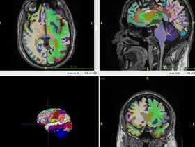 اكتشاف آلية جديدة لوصول الهرمونات إلى الدماغ