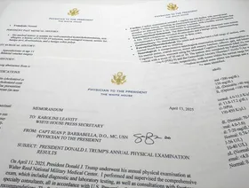 ترمب يدافع عن صحته: نادم على فحص القلب والبطن لأنه أثار الجدل