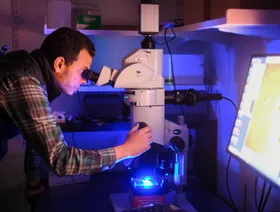 بينهم مصري.. فريق بحثي يقدم أملاً لعلاج الخرف واضطرابات تدفق الدم في الدماغ