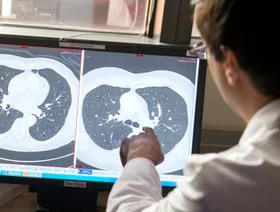 العلاج بالأشعة تحت الحمراء.. هل يدمّر الخلايا السرطانية؟