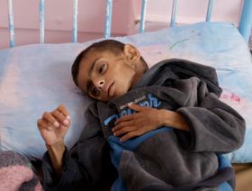 غزة بين القصف والأوبئة.. القطاع الصحي على حافة الانهيار
