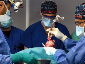 نهج مبتكر في علاج سرطان الرئة بالإشعاع يقلل خطر إصابة القلب