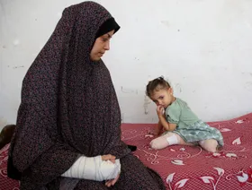 مبتورو الأطراف في غزة.. لا رعاية ولا أمل