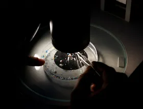 دراسة: الجسيمات البلاستيكية الدقيقة تغير أعداد البكتيريا المعوية النافعة