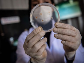 اكتشاف "حيلة" جديدة تستخدمها البكتيريا لمقاومة المضادات الحيوية