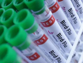 وفاة شخص بواشنطن في أول إصابة مؤكدة بسلالة H5N5 من إنفلونزا الطيور