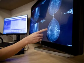 باحثون صينيون يستخلصون مركباً من بكتيريا بحرية يدمر السرطان