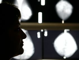 لجنة أميركية: فحص سرطان الثدي يجب أن يبدأ في سن الأربعين