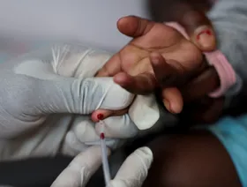 دراسة: تحليل دم جديد يتنبأ بدقة أكبر بتطور أمراض الكلى