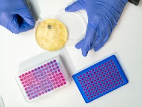 اكتشاف آلية جديدة وراء مقاومة البكتيريا للمضادات الحيوية