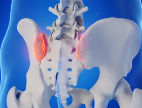 التهاب المفصل العجزي الحرقفي.. الأعراض والأسباب والعلاج