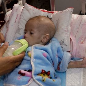 الأونروا: سوء التغذية يظهر على طفل من كل 10 في غزة