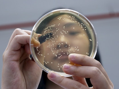 باحثة بأحد المختبرات في سنغافورة تفحص عينة من البكتيريا. 24 أبريل 2015 - REUTERS