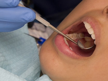 طبيب يفحص أسنان أحد المرضى - الشرق