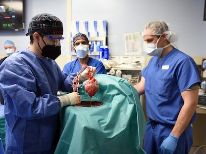 جراحون يزرعون قلب خنزير في إنسان. ماريلاند الولايات المتحدة الأميركية. 10 يناير 2022. - AFP