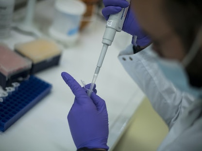 عامل صحي في مختبر  يقوم بفحص عينة بكتيرية في رومانفيل بالقرب من باريس. 8 نوفمبر 2021  - AFP