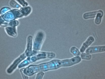 اكتشاف دور جديد لبروتين قديم في حماية المادة الوراثية داخل الخلايا