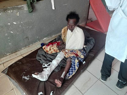 أحد الناجين من غارة جوية شنتها القوات الحكومية الإثيوبية يتلقى العلاج في مستشفى ببلدة ديديبت في تيجراي بإثيوبيا - 8 يناير 2022 - REUTERS