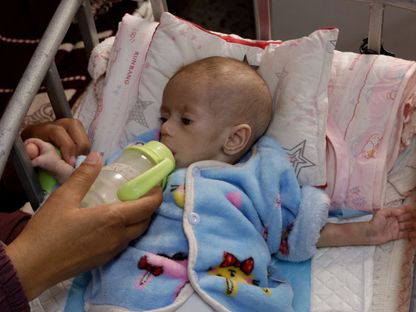 رضيعة فلسطينية تعاني من سوء التغذية في مستشفى ناصر جنوب قطاع غزة، 30 أبريل2025 - Reuters
