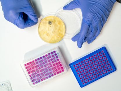 اختبار مقاومة المضادات الحيوية. 14 ديسمبر 2022 - AFP