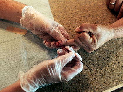 استخراج عينة دم للكشف عن الكوليسترول لشخص في نيويورك، الولايات المتحدة - 20 يوليو 2010 - AFP