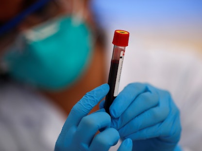 عامل صحي يحمل عينة دم أثناء اختبار في منطقة ميرافلوريس في ليما عاصمة بيرو  - REUTERS
