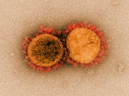 صورة مجهرية إلكترونية لجزيئات فيروس كورونا - REUTERS