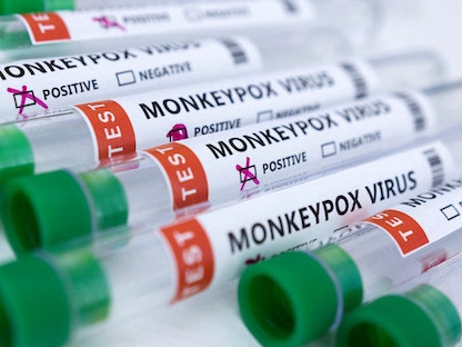 أنابيب اختبار مكتوب عليها "فيروس جدري القرود" - REUTERS