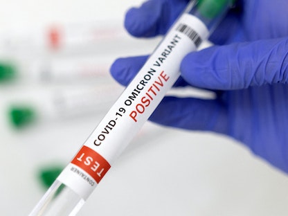 نتيجة إيجابية لاختبار سلالة أوميكرون من فيروس كورونا (صورة توضيحية)، 15 يناير 2022. - REUTERS