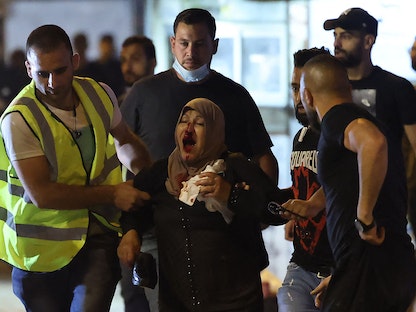 مواطنة فلسطينية تتلقى الإسعاف بعد إصابتها في مواجهات مع القوات الإسرائيلية في محيط القدس ليلة السبت 8 مايو 2021. - AFP